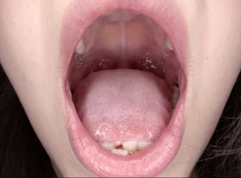 GAT-025 第 10 部分 - 138 分钟