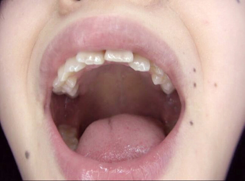 GAT-025 第 11 部分 - 150 分钟