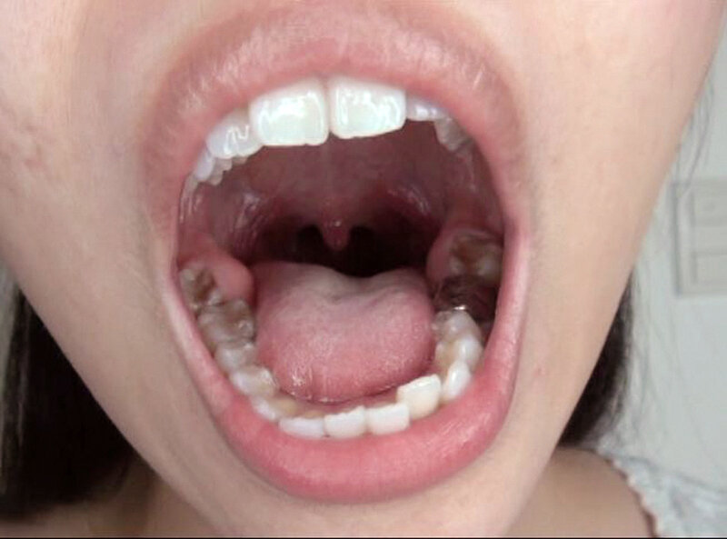 GAT-025 Bagian 14 - 186 minit