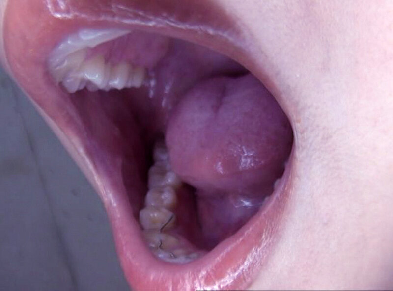 GAT-025 第 17 部分 - 222 分钟