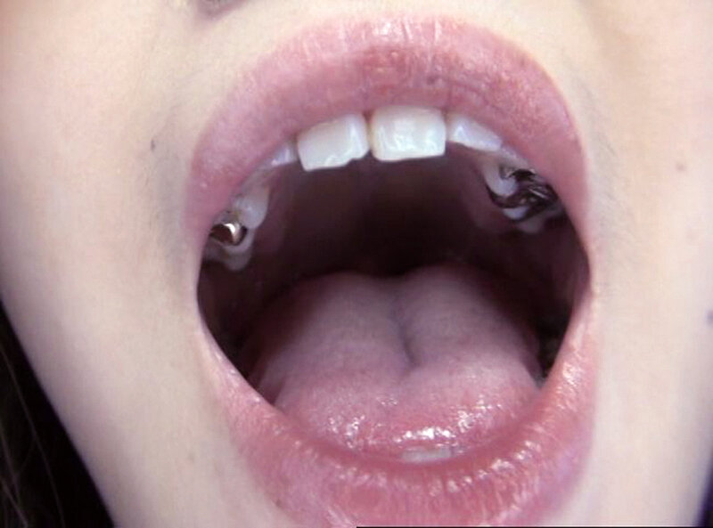 GAT-025 Bagian 18 - 234 minit