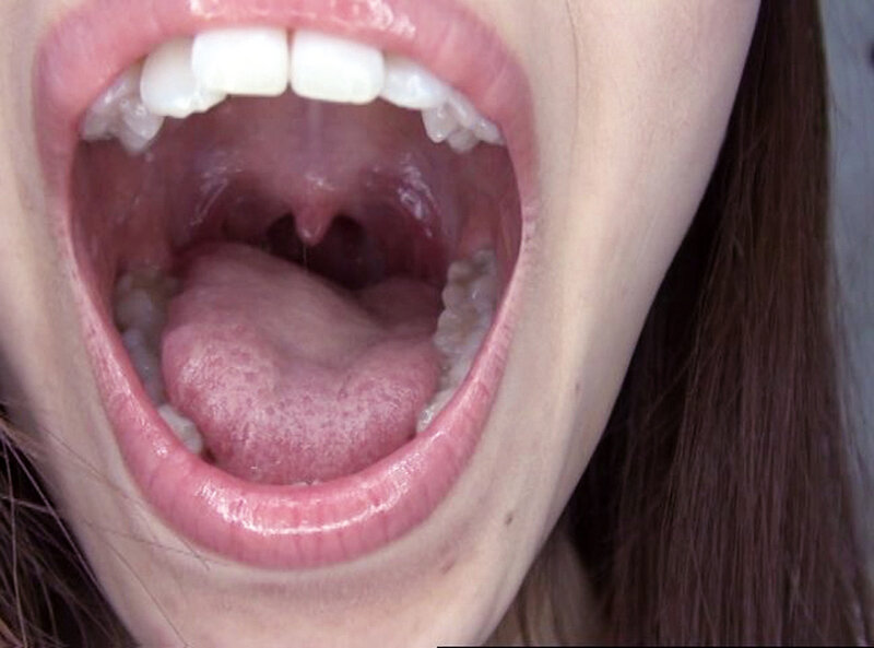 GAT-025 Bagian 20 - 258 minit