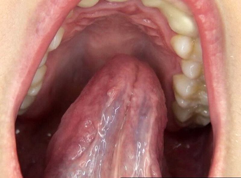 GAT-025 Bagian 4 - 66 minit