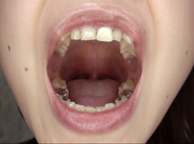 GAT-025 Bagian 7 - 102 minit