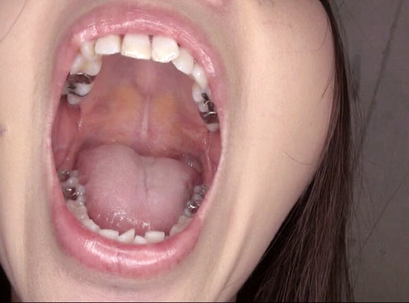 GAT-025 Bagian 8 - 114 minit