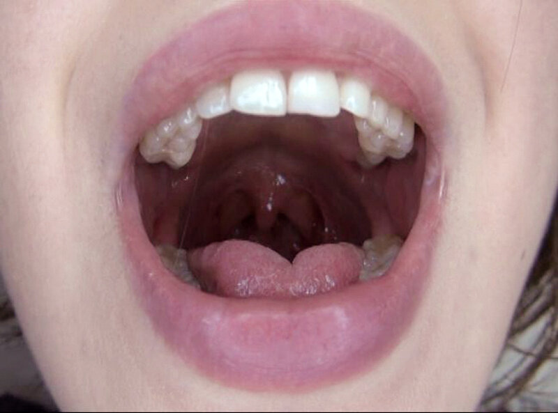 GAT-025 第 9 部分 - 126 分钟