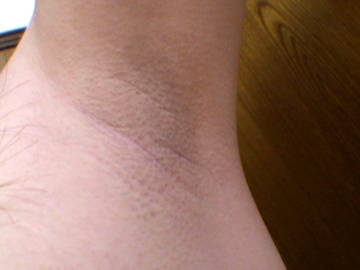 GERB-017 第 13 部分 - 78 分钟