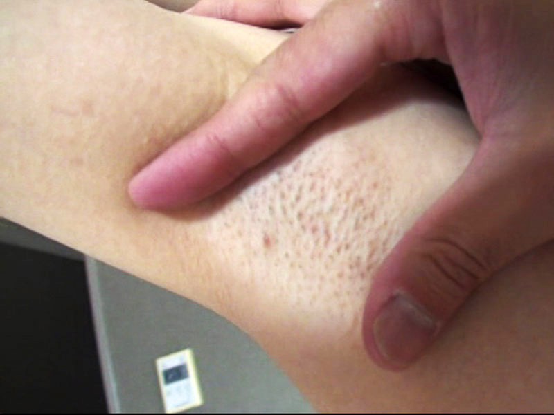 GS-01285 第 3 部分 - 40 分钟