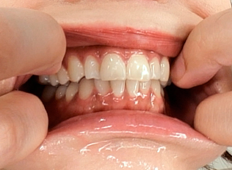 CASMANI-037 Bagian 14 - 56 minit