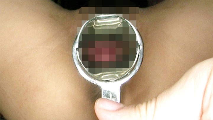 OL-181 Bagian 10 - 84 minit