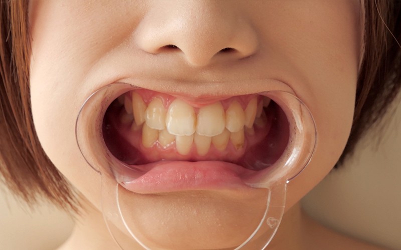 AD-106 第 6 部分 - 30 分钟