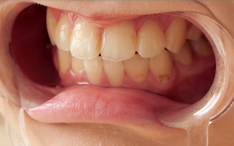 AD-106 第 8 部分 - 30 分钟