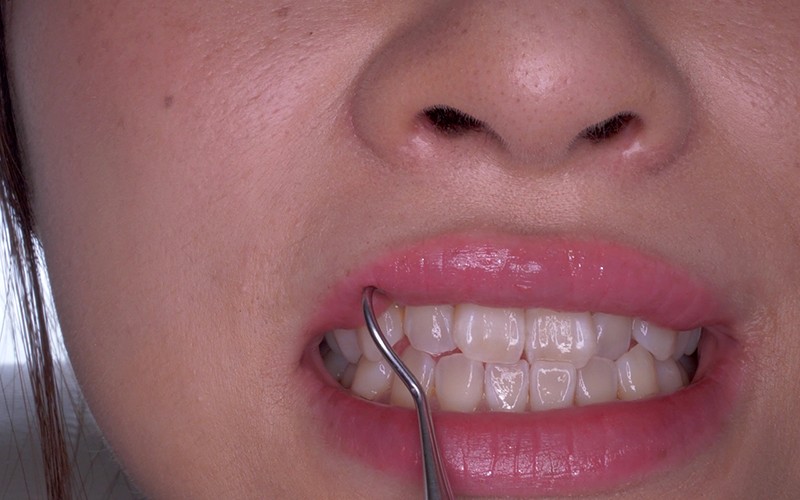 AD-111 第 10 部分 - 39 分钟