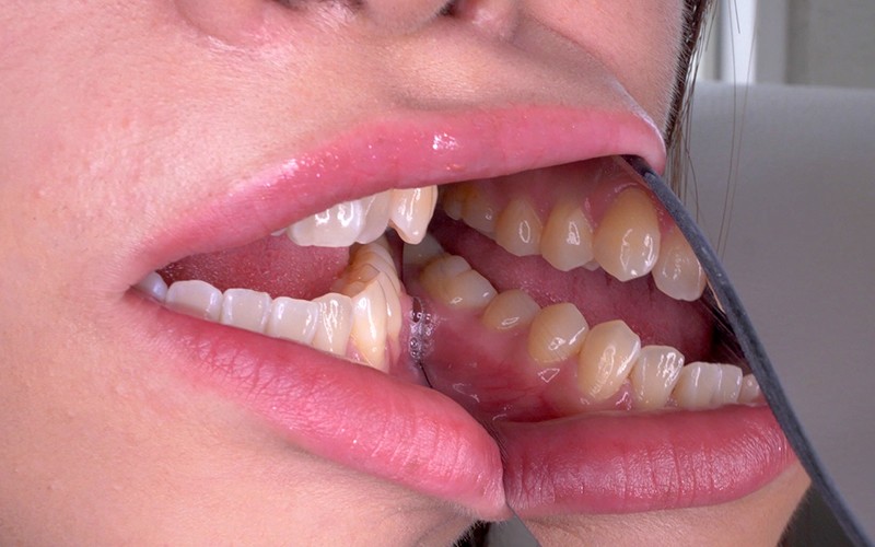 AD-111 第 15 部分 - 44 分钟