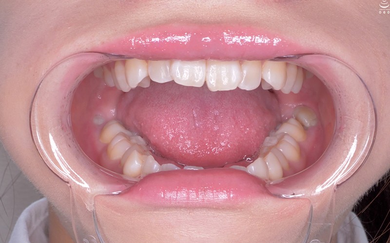 AD-111 第 4 部分 - 33 分钟