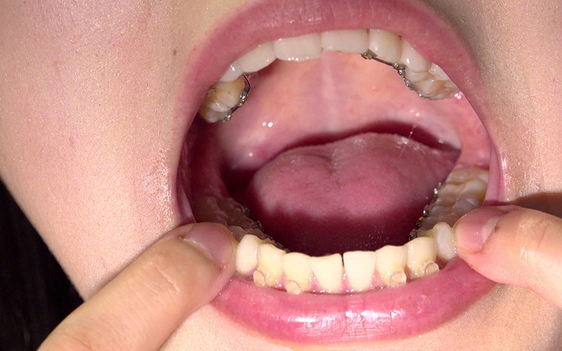 AD-128 Bagian 10 - 30 minit