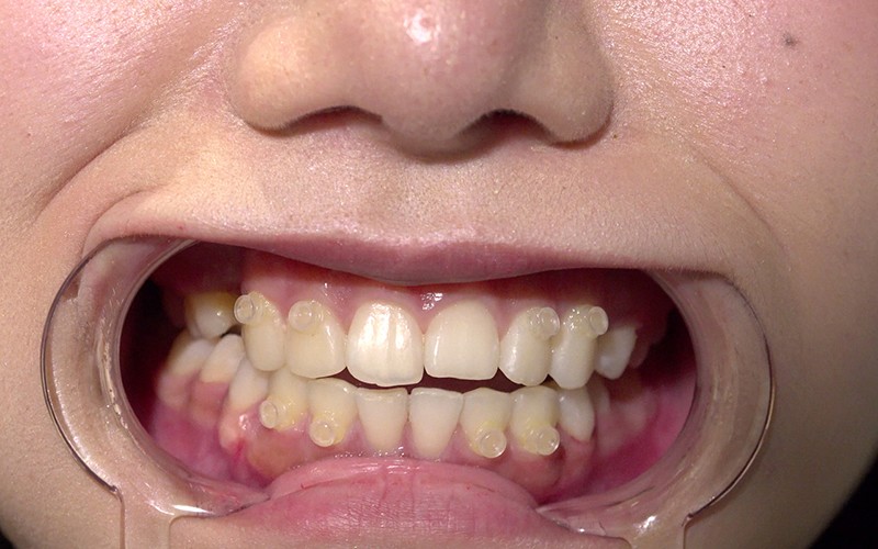 AD-128 第 2 部分 - 30 分钟