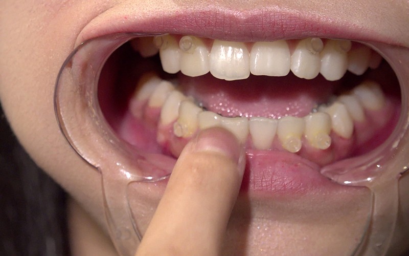 AD-128 Bagian 4 - 30 minit