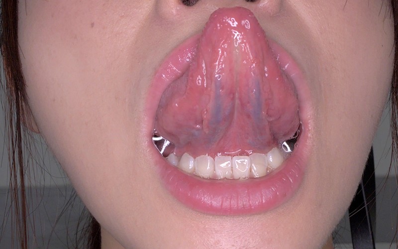 AD-160 Part 11 - 30 minutes