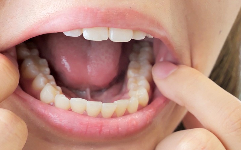 AD-171 Part 10 - 30 minutes