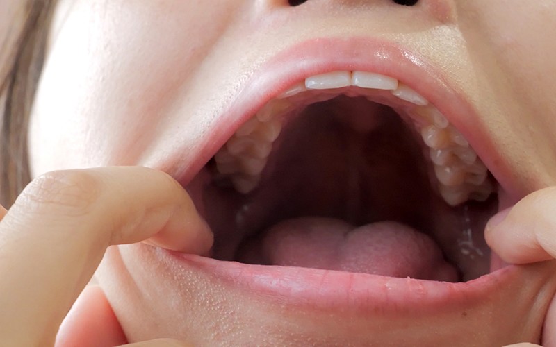 AD-171 Part 11 - 30 minutes