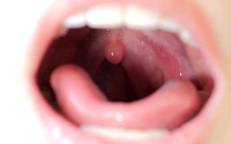 AD-171 Part 12 - 30 minutes