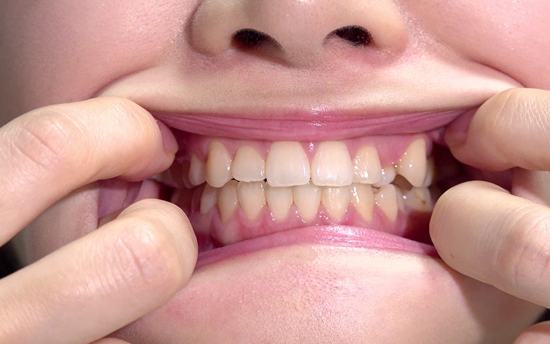 AD-180 第 10 部分 - 39 分钟