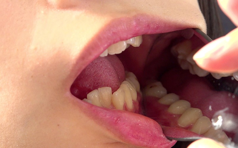 AD-196 Part 14 - 30 minutes