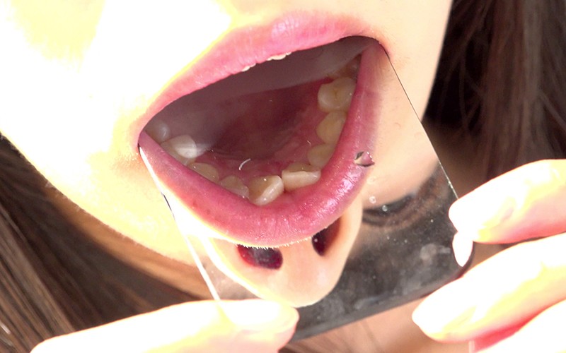 AD-196 Part 15 - 30 minutes