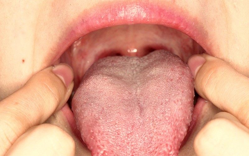 AD-215 Bagian 15 - 30 minit