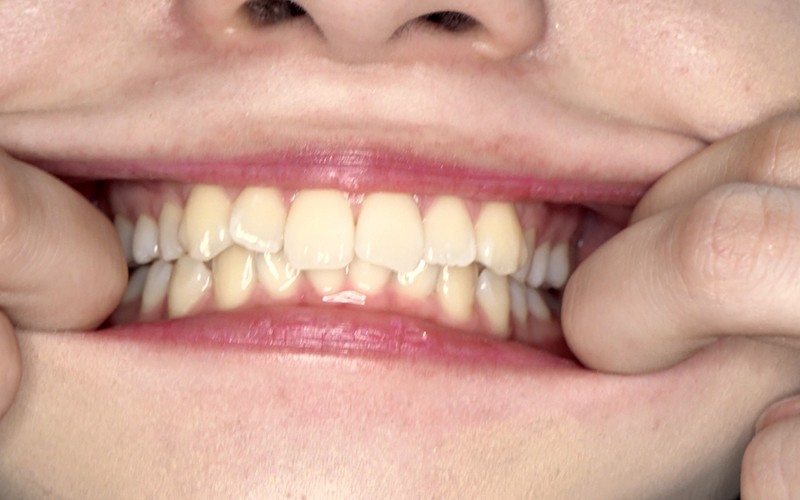 AD-215 Bagian 9 - 30 minit