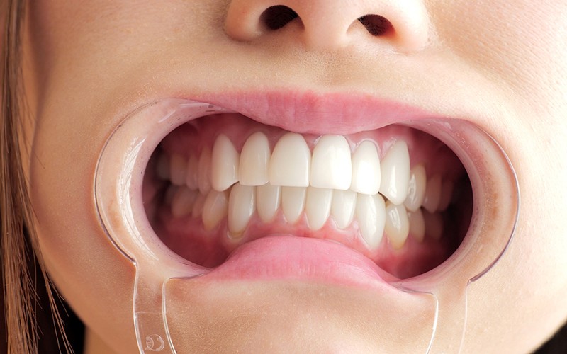 AD-219 Bagian 10 - 30 minit