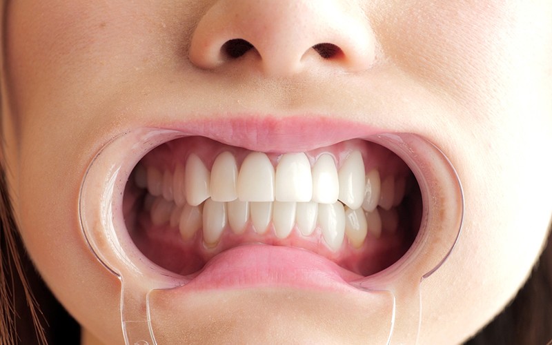 AD-219 Bagian 9 - 30 minit