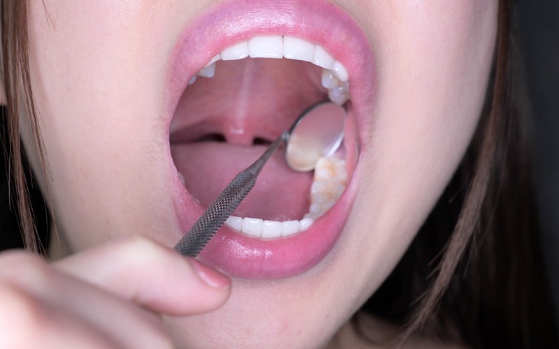 AD-221 Bagian 17 - 30 minit