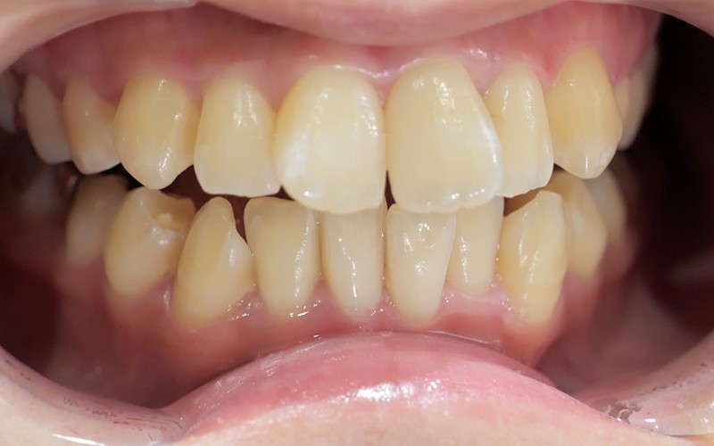 AD-235 Part 5 - 34 minutes