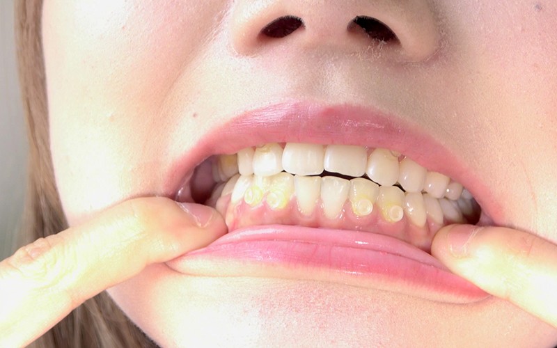 AD-250 Bagian 10 - 30 minit