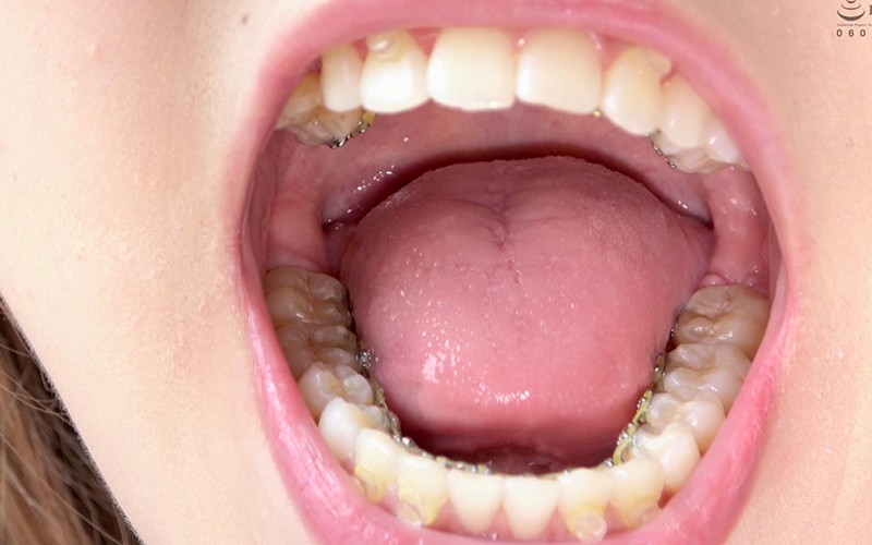 AD-250 Bagian 11 - 30 minit