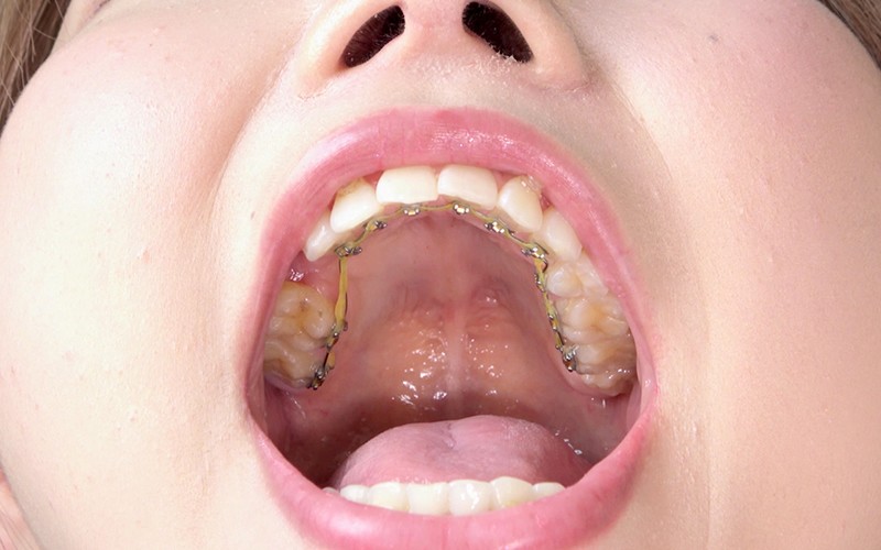 AD-250 Bagian 14 - 30 minit