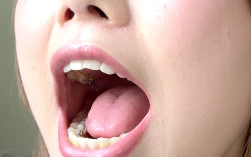 AD-250 第 8 部分 - 30 分钟