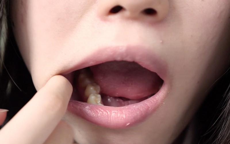 AD-260 第 13 部分 - 30 分钟