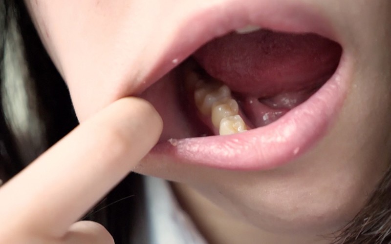 AD-260 第 14 部分 - 30 分钟