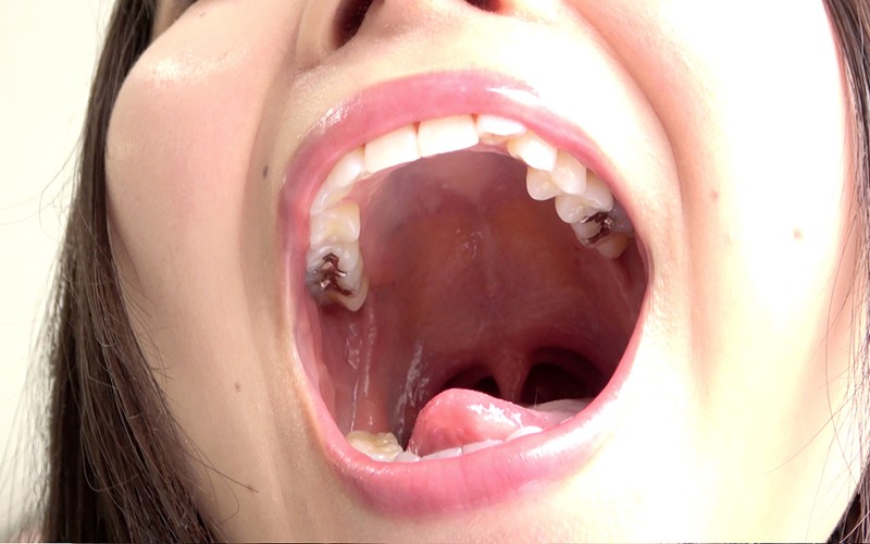 AD-278 Part 10 - 30 minutes