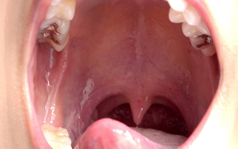 AD-278 Part 11 - 30 minutes