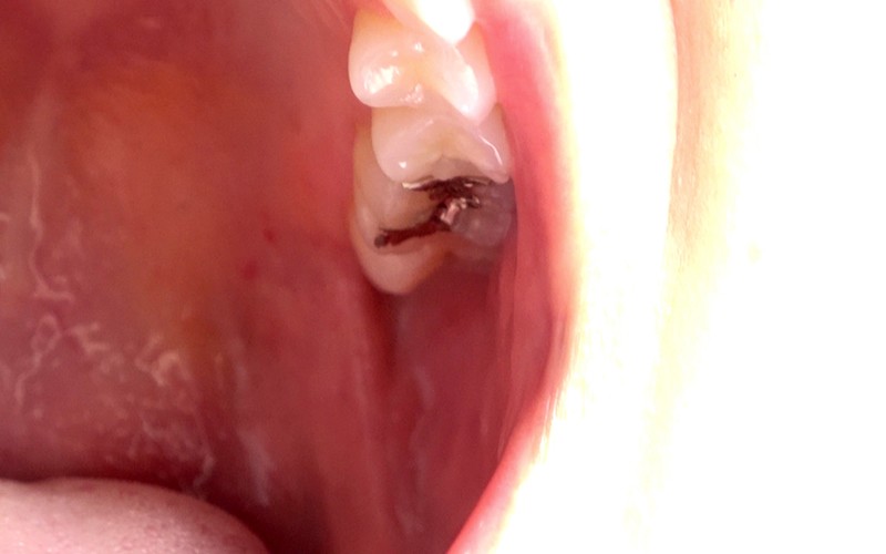 AD-278 Part 12 - 30 minutes