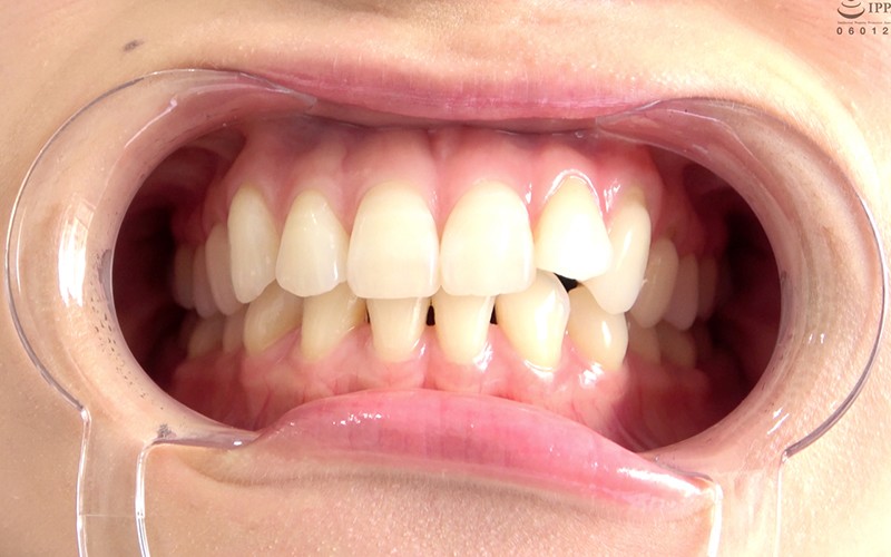 AD-278 Part 3 - 30 minutes