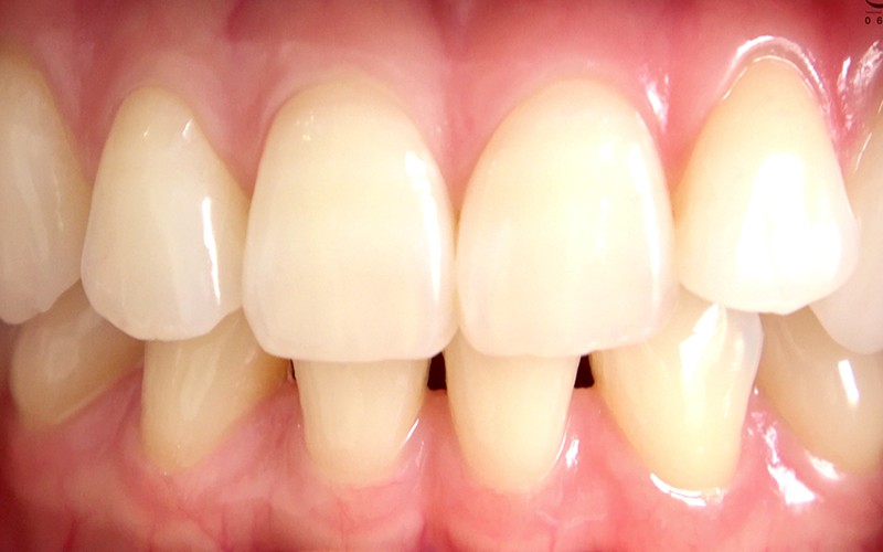 AD-278 Part 4 - 30 minutes