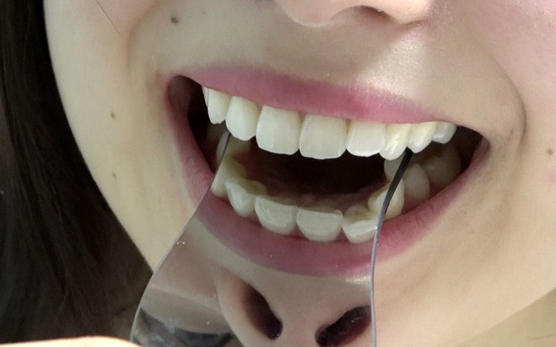 AD-285 第 9 部分 - 30 分钟