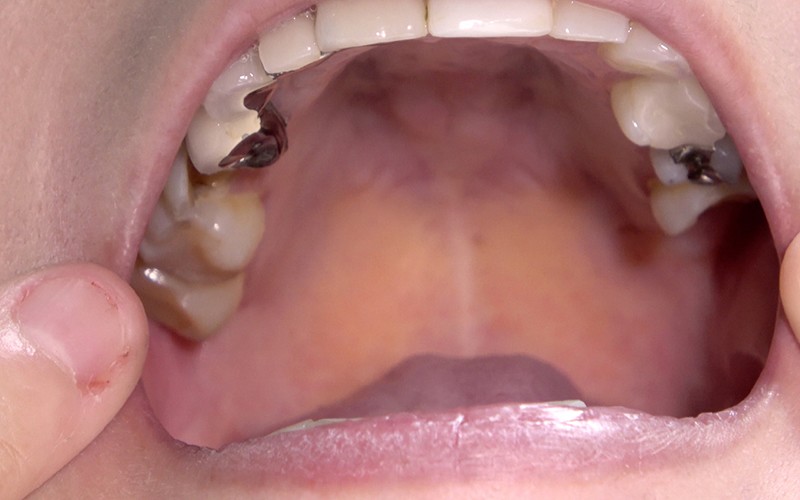 AD-287 第 10 部分 - 30 分钟