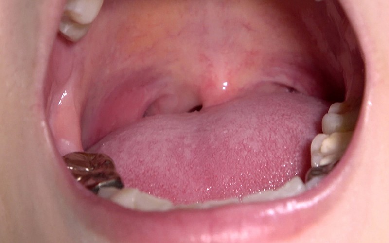 AD-287 第 14 部分 - 30 分钟