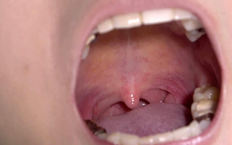 AD-287 Bagian 15 - 30 minit